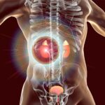 can ozempic cause kidney problems