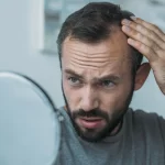 can wegovy cause hair loss