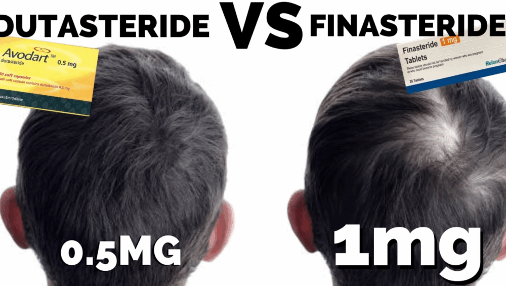 finasteride vs dutasteride