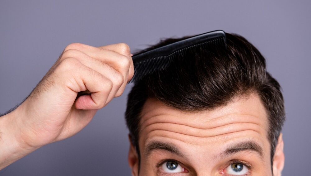 finasteride vs hair transplant