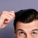finasteride vs hair transplant